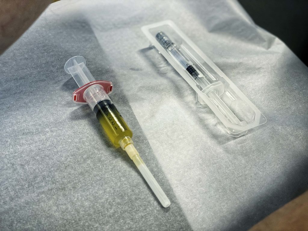 Sprøyter som brukes ved injeksjonsbehandling og prp